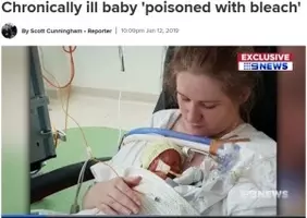 漂白剤のお風呂に週に2回 道化師様魚鱗癬と闘う1歳児 米 18年6月23日 エキサイトニュース