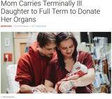 「お腹の赤ちゃんが無脳症と診断された夫婦　臓器提供を決意し出産　「限られた命の娘に一生分の愛を注いだ」（米）」の画像1
