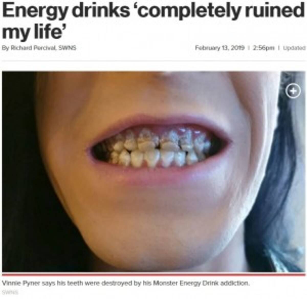 モンスターエナジーを飲み過ぎた男性 全ての歯がボロボロに 歯科医 これまで診た中で最も酷い 英 2019年2月19日 エキサイトニュース