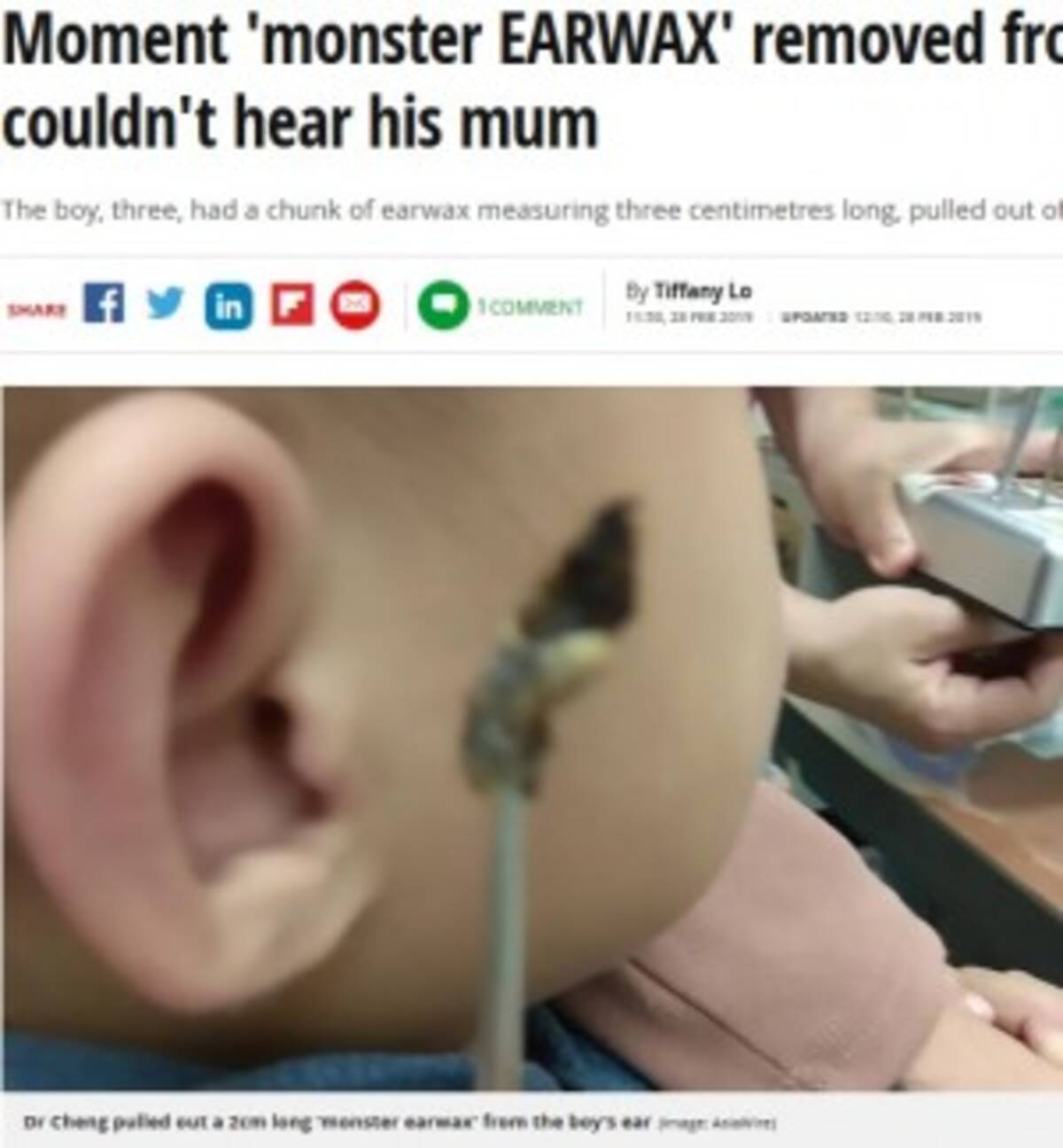 母親の声が聞こえなかった幼児に巨大な耳垢が 台湾 19年3月4日 エキサイトニュース