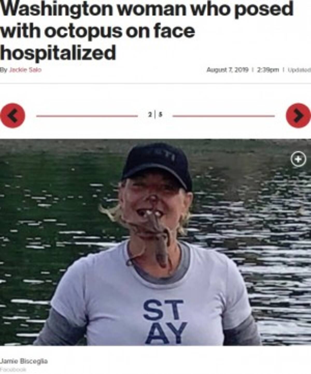 タコを顔に載せて写真撮影した女性 噛まれて出血し病院へ 米 19年8月10日 エキサイトニュース