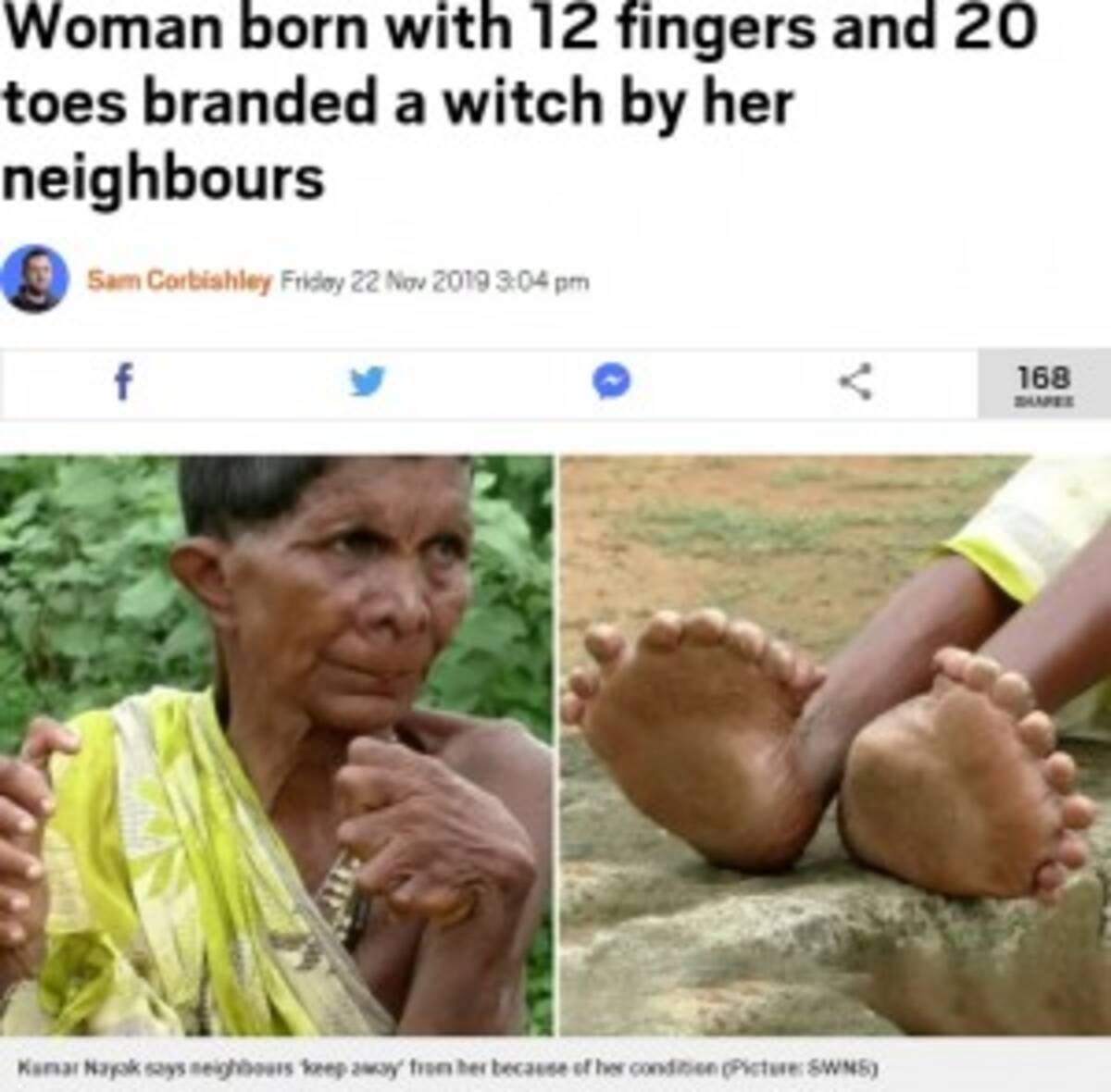 足指本と手指12本を持つ女性 魔女は家にいろ と言われ続けて63年 印 19年11月25日 エキサイトニュース