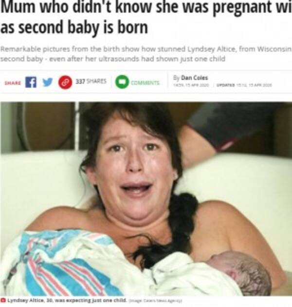 1人だと思っていたお腹の子 出産したら双子だった 当時はショックも今はかけがえのない存在に 米 年4月17日 エキサイトニュース