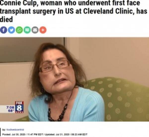 米国初の顔面移植手術を受けた女性が死去 心が美しい人だった と医師 動画あり 年8月3日 エキサイトニュース