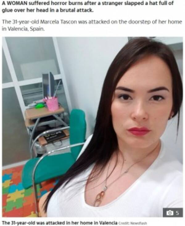 浮気の報復か 見知らぬ男に接着剤入りの帽子を被せられた女性 頭皮を火傷 スペイン 年8月3日 エキサイトニュース