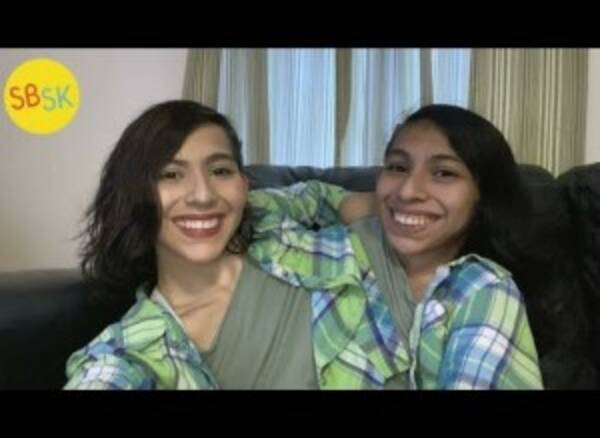 3日もてばいい と言われた結合双生児が歳に 私たちは2人の個性ある人間 米 動画あり 年8月10日 エキサイトニュース