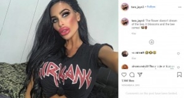 美容整形に780万円かけた31歳女性「次は瞳の色を変えて肋骨を切除したい」（豪）