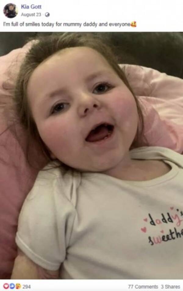 生後9か月に髄膜炎で四肢切断した女児 来月で4歳に 笑顔でいてくれればいい と母親 英 動画あり 年11月1日 エキサイトニュース