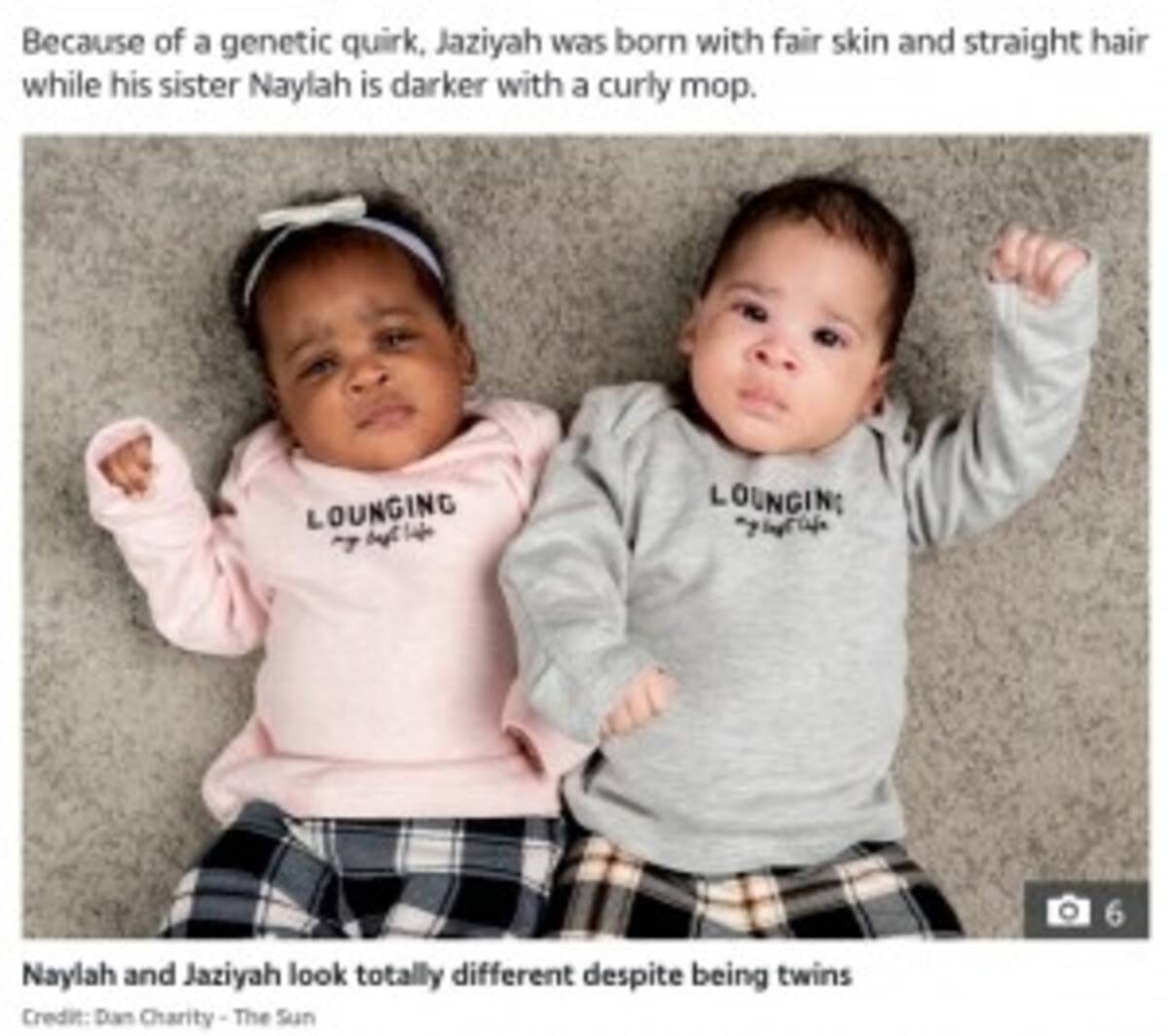 肌の色も髪質も全く異なる4か月の双子姉妹 でも目の色と顔はそっくり 英 21年2月2日 エキサイトニュース