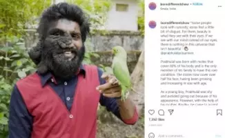 人呼んで ゴム少年 世界一柔軟な身体 でギネス世界記録を目指す歳男性 印 動画あり 年10月31日 エキサイトニュース 2 2 人呼んで ゴム少年 世界一柔軟な身体 でギネス世界記録を目指す歳男性 印 動画あり 年10月31日 エキサイトニュース 2 2