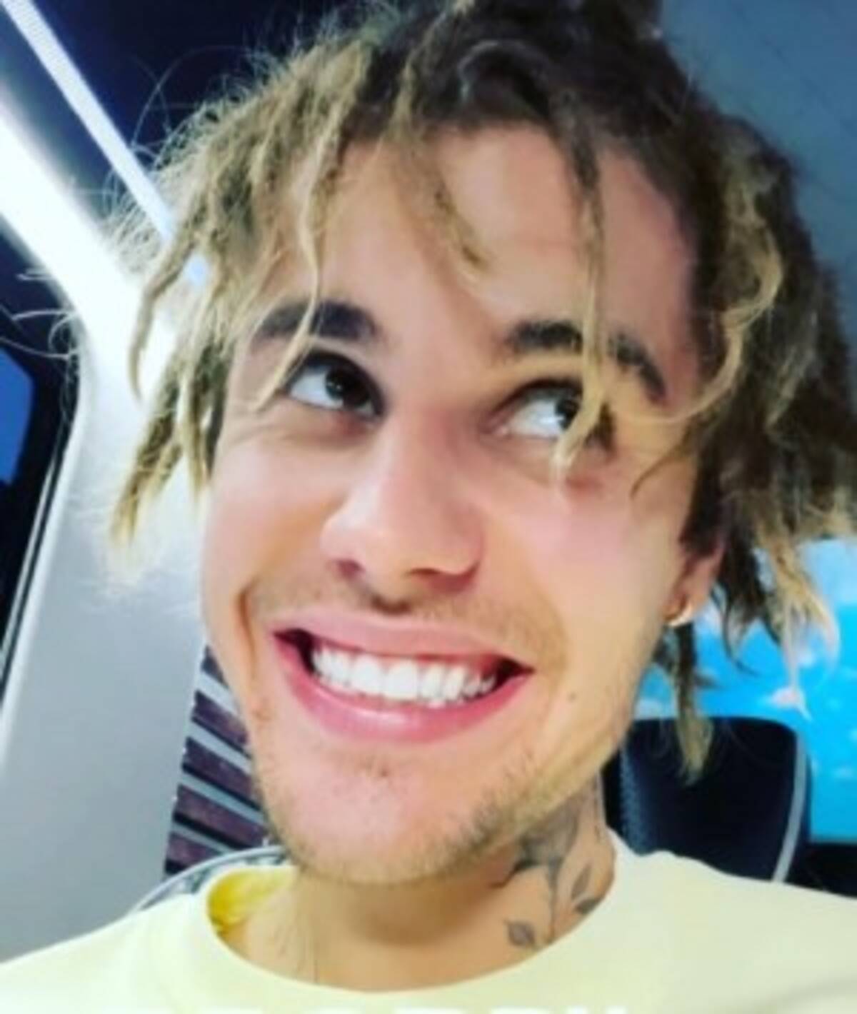 ジャスティン ビーバー 非難を浴びたドレッドヘアから丸刈りに 似合ってる ファン絶賛 21年5月25日 エキサイトニュース ジャスティン ビーバー 非難を浴びたドレッドヘアから丸刈りに 似合ってる ファン絶賛 21年5月25日 エキサイトニュース