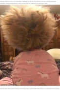 「櫛でとかせない頭髪症候群」の明るい6歳女児に「ゴージャス」の声（英）