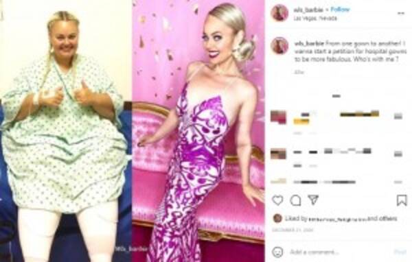憧れはバービー人形 93キロ減量し たるんだ皮膚や手術痕もありのままを晒す女性 米 動画あり 21年10月21日 エキサイトニュース