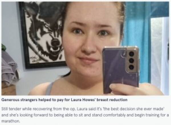 Pカップの胸に悩まされていた女性 寄付を募り縮小手術を受ける 英 21年11月15日 エキサイトニュース