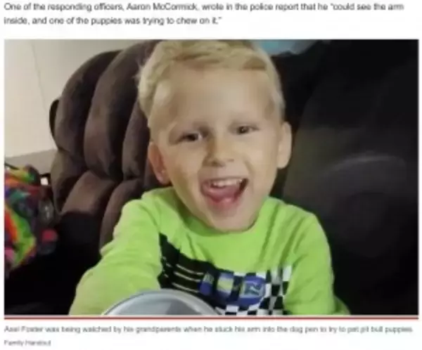 「ピットブルの檻に手を入れた4歳男児、右腕を噛みちぎられる（米）」の画像