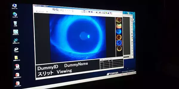 長時間PCやスマホ依存、悲鳴をあげる目の角膜＿ドライアイ猛威を予防するポイントを専門医や研究員に聞く