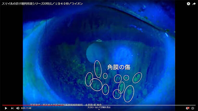 長時間PCやスマホ依存、悲鳴をあげる目の角膜＿ドライアイ猛威を予防するポイントを専門医や研究員に聞く