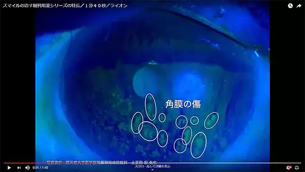 「長時間PCやスマホ依存、悲鳴をあげる目の角膜＿ドライアイ猛威を予防するポイントを専門医や研究員に聞く」の画像