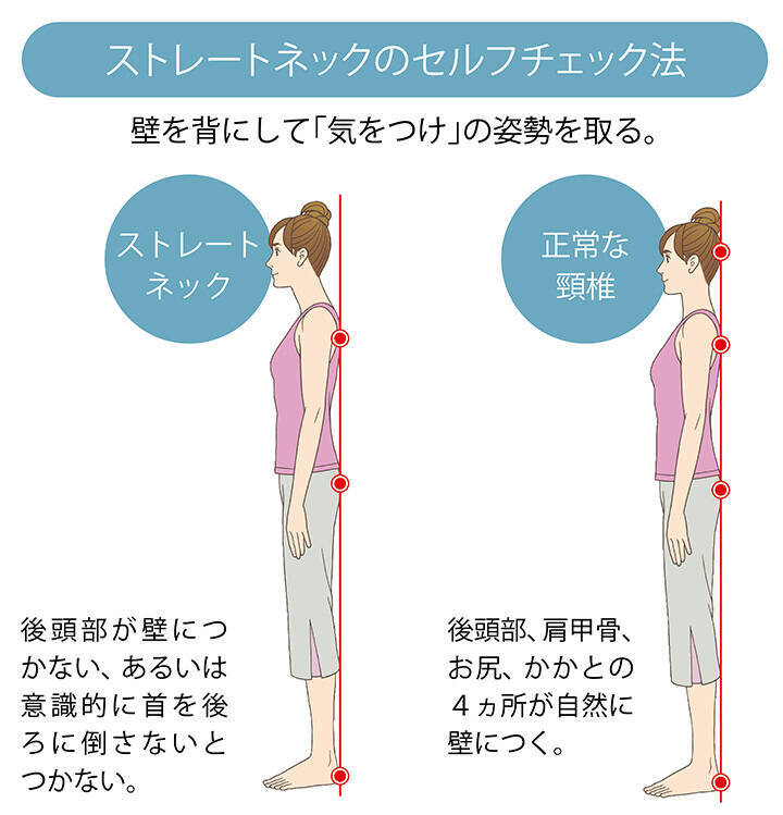 首や肩の痛みは スマホ首 が原因だった 年10月22日 エキサイトニュース 4 9