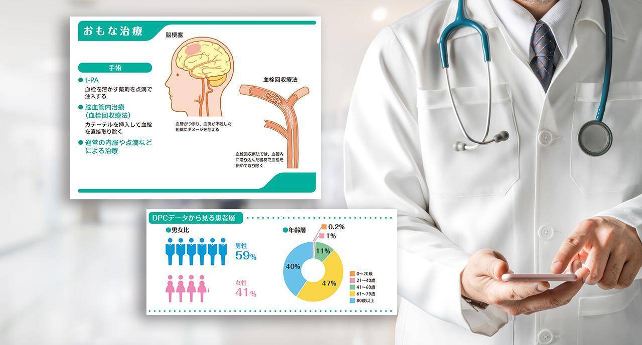 脳梗塞 治療実績から分かった地域別 北海道 沖縄 全国病院ランキング 年2月23日 エキサイトニュース