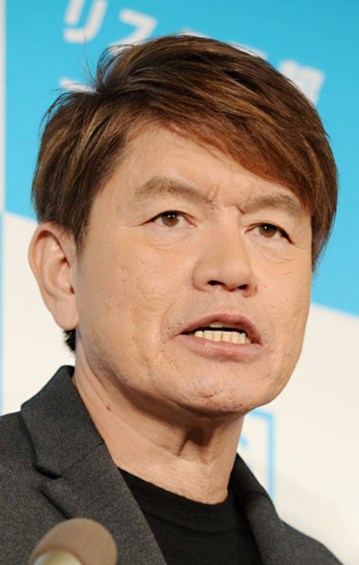 ヒロミ 故竹内結子さんの気遣いエピソード明かす 私がプールに落ちたほうがいいですか 年9月29日 エキサイトニュース