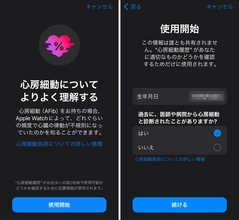 Apple Watchの「心房細動履歴」が国内でも利用可能に