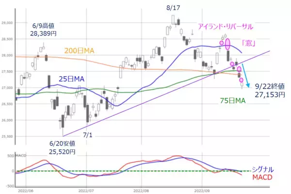 「もうちょい先？本格的な日本株買いの好機いつ」の画像