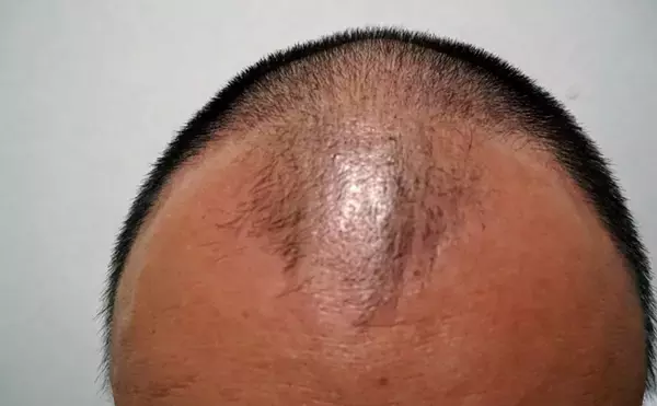 「「海藻が髪にいい」ってホント？　頭髪の生育に必要な栄養を多く含んでいるのは事実」の画像