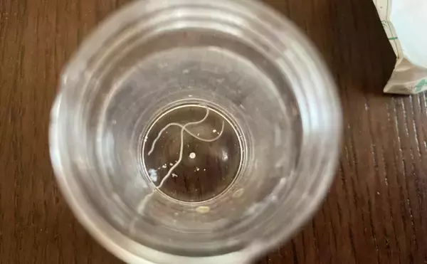 「わずか100万分の1秒でアニサキスを殺虫する技術が開発される　量産化に期待！」の画像