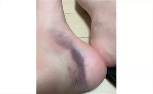 「釣りの「めっちゃ痛い！」思い出　深夜に消波ブロックへ落下して奇跡の生還」の画像