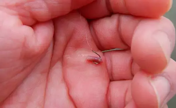 「都内の公園でブルーギルの数釣り堪能　魚影抜群で2時間強で100匹超え」の画像