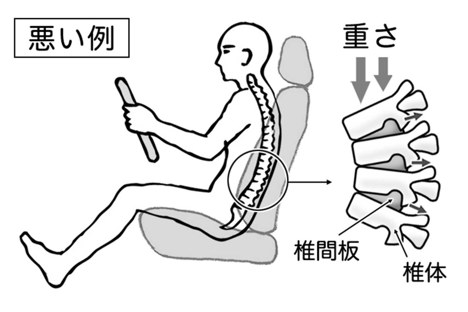 長距離走行でドライバーを襲う「腰痛」！　地獄の痛みから解放される手段を考えた