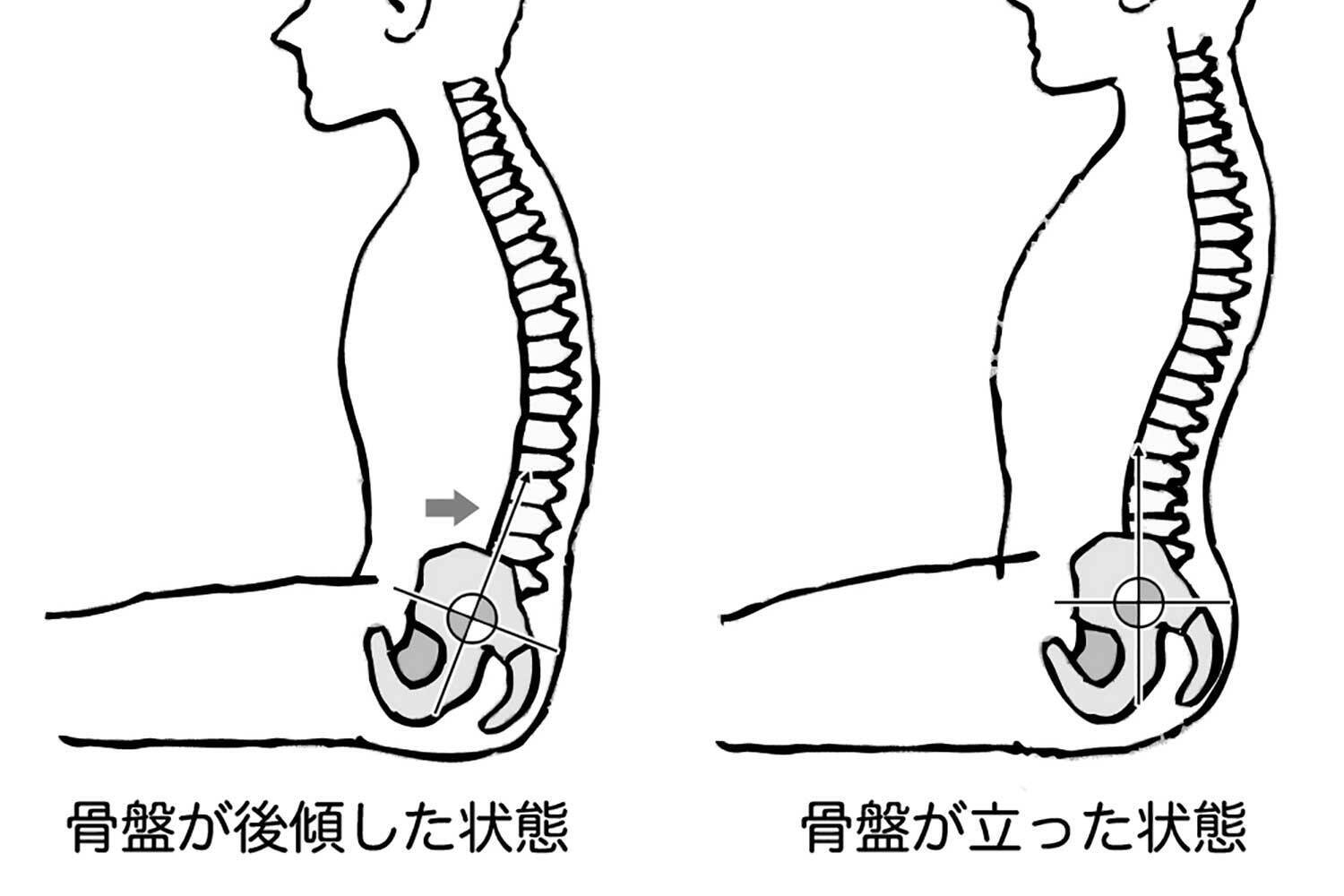 長距離走行でドライバーを襲う「腰痛」！　地獄の痛みから解放される手段を考えた