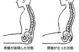 「長距離走行でドライバーを襲う「腰痛」！　地獄の痛みから解放される手段を考えた」の画像6