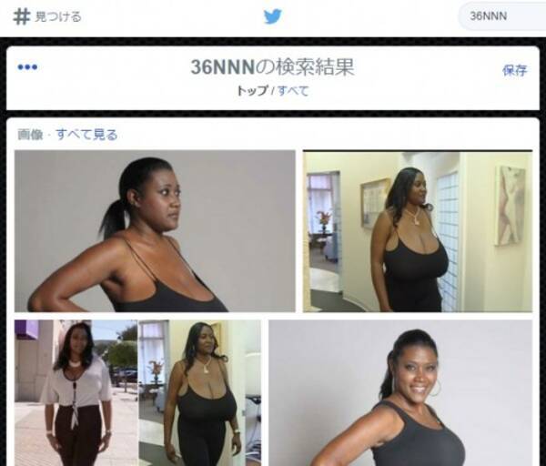 Pカップ の巨乳女性が話題 手術でｅカップにサイズダウンした理由とは 14年11月14日 エキサイトニュース