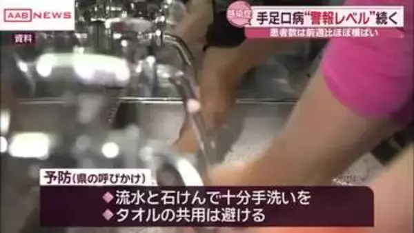 秋田県内の手足口病「警報レベル」続く　前週比ほぼ横ばい
