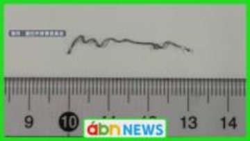 小学校の給食に針金混入　児童が口にする前に発見し健康被害なし　教育委員会が再発防止へ【長野・飯田市】