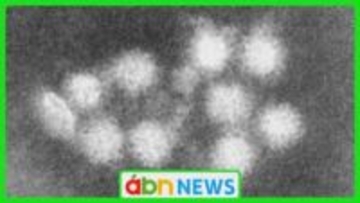 弁当や仕出し料理食べ…上田市内の飲食店で提供された食事を食べた男女26人体調不良に ノロウイルスを検出【長野・上田市】