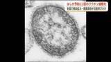 「「はしか」の感染、全国で拡大　「ワクチンの早期接種を」　秋田県医師会、適切な予防措置取るよう注意喚起」の画像1