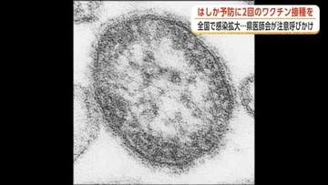 「はしか」の感染、全国で拡大　「ワクチンの早期接種を」　秋田県医師会、適切な予防措置取るよう注意喚起