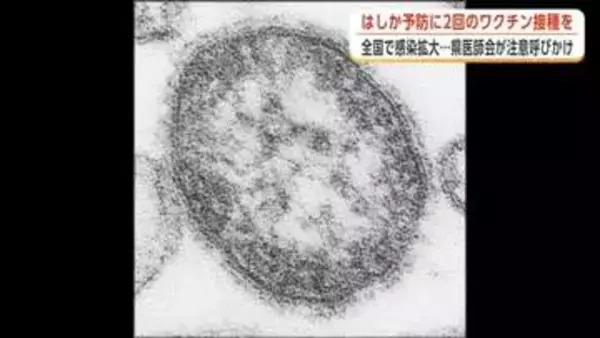 「はしか」の感染、全国で拡大　「ワクチンの早期接種を」　秋田県医師会、適切な予防措置取るよう注意喚起