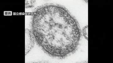 富山市の40代の女性がはしかに　12日に確認された患者の接触者で2次感染か