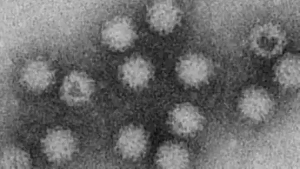 富山県がノロウイルス食中毒警報を発令、先月から4件77人が感染