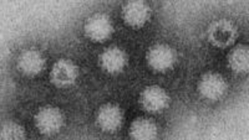 富山県がノロウイルス食中毒警報を発令、先月から4件77人が感染