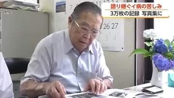 当時18歳の若き写真家が記録したイタイイタイ病　76歳の今、ついに写真集に「風化させたくない」