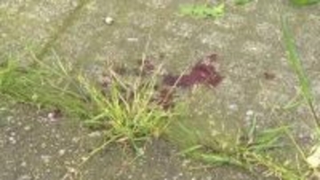 富山市の住宅街にクマ出没、40代女性が顔や頭を負傷　被害女性の夫「他に被害がないよう早く見つかって」