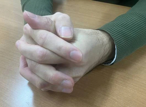 「発達障害」理由の解雇やアウティングは「違法」、障害者事業所に80万円賠償命令　賃金請求は認められず