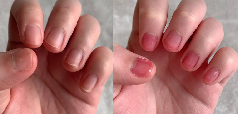 ボロボロの自爪は蘇るか 無印 の人気ネイルケアグッズで試してみた 22年2月24日 エキサイトニュース 3 3