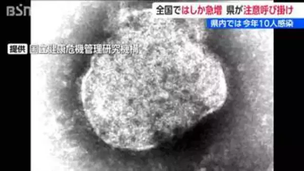 全国の『はしか』感染者数 1週間で1.4倍に急増　新潟県も注意呼びかけ