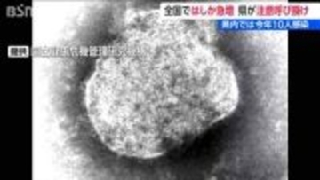 全国の『はしか』感染者数 1週間で1.4倍に急増　新潟県も注意呼びかけ